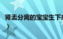 肾盂分离的宝宝生下来有什么症状（肾盂分离）