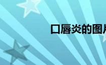 口唇炎的图片（口唇炎）