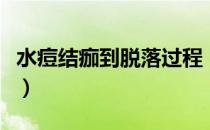 水痘结痂到脱落过程（水痘结痂到脱落要几天）