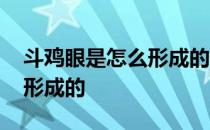 斗鸡眼是怎么形成的会遗传吗 斗鸡眼是怎么形成的