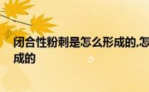 闭合性粉刺是怎么形成的,怎么去改善 闭合性粉刺是怎么形成的