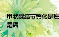 甲状腺结节钙化是癌的几率 甲状腺结节钙化是癌