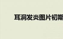 耳洞发炎图片初期（耳洞发炎图片）