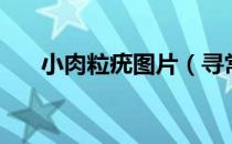 小肉粒疣图片（寻常疣图片初期图片）