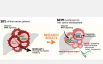对肝癌发展的新见解