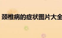 颈椎病的症状图片大全（颈椎病的症状图片）