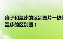痱子和湿疹的区别图片一热就痒的是痱子还是湿疹（痱子和湿疹的区别图）