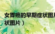 女胃癌的早期症状图片大全（女胃癌的早期症状图片）