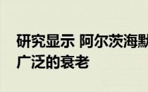 研究显示 阿尔茨海默氏症候选药物可逆转更广泛的衰老